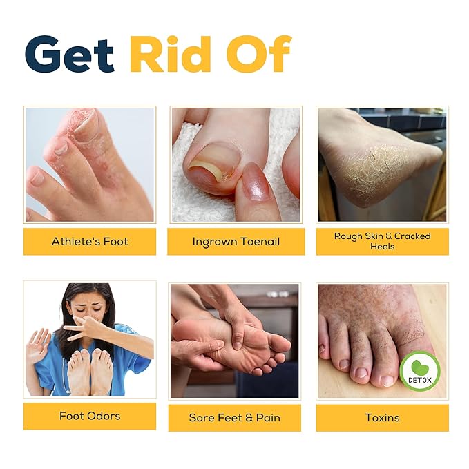 FOOT CURE Citrus Detox Foot Soak - Image 6