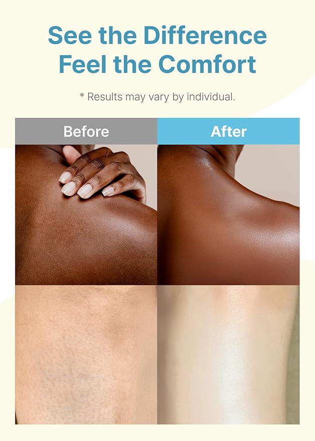 Derma B | Daily Moisture Body Oil | 99% Natural Argan & Sweet Almond Oil | - Image 3