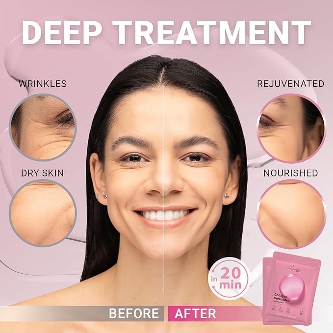 VIABEAUTY 12 Pack of Collagen Face Mask - Image 2