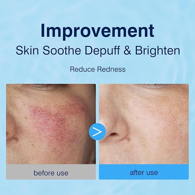 3% Hyaluronic Acid Collagen Peptide Toner Pad, Hyaluronic Acid Toners Facial - Image 2