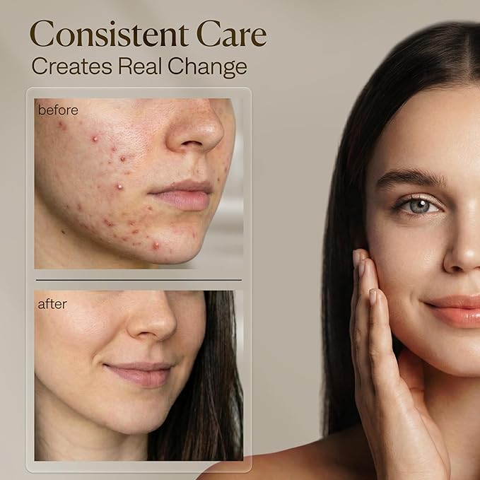 VogueNow Facial Steamer Spa Kit - Image 7