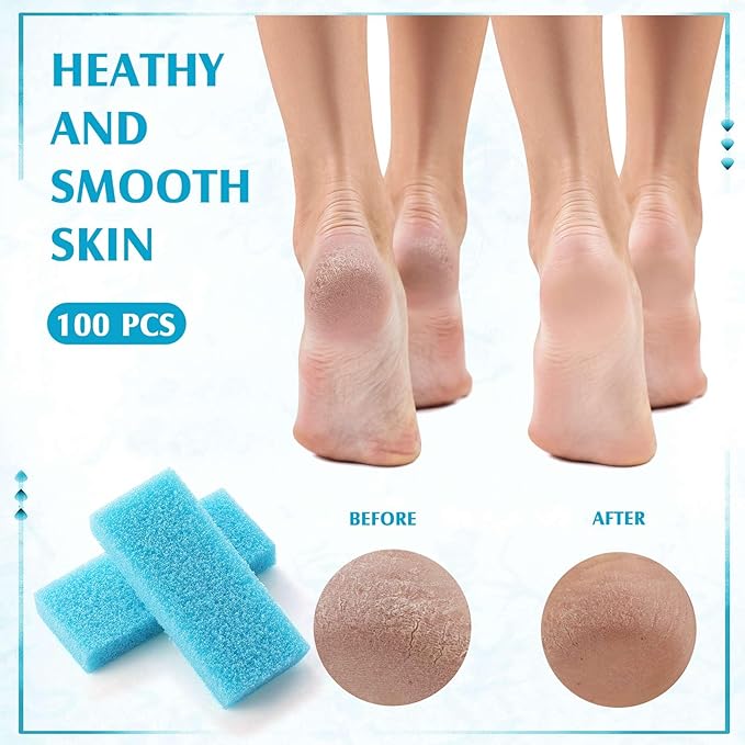 Batiyeer 100 Pcs Pumice Stone for Feet Scrubber Dead Skin Disposable Pedicure - Image 4