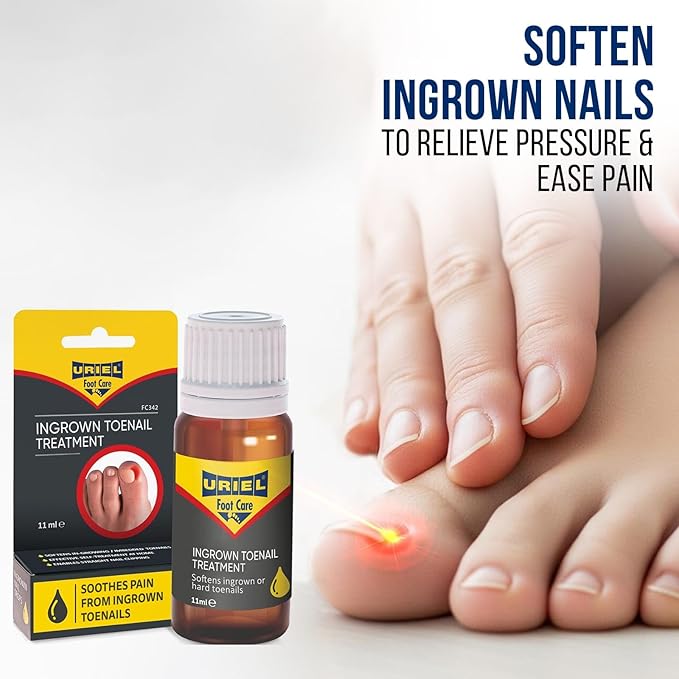 URIEL UPGRADED Ingrown Toenail Treatment, Ingrown Toenail Removal Kit, Ingrown - Image 3