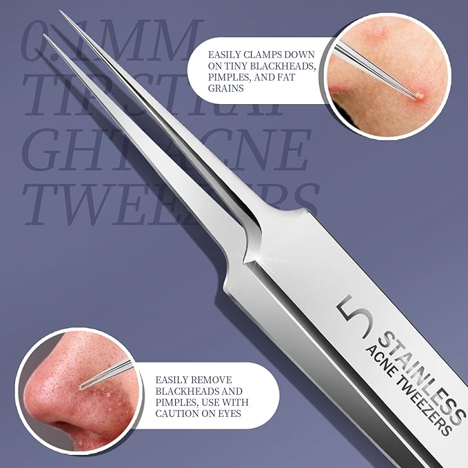 Teenitor 7 Pcs Pimple Popper Tool Kit, Surgical Grade Blackhead Remover Tools - Image 4