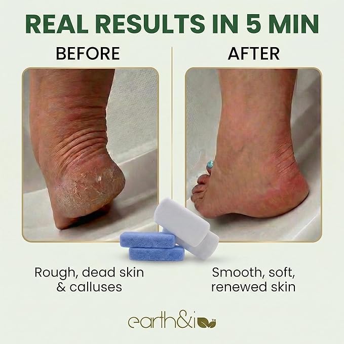 Earth & I Pumice Stone for Feet – 6-Pack Callus Remover Set | 3 Coarse + 3 Fine - Image 2