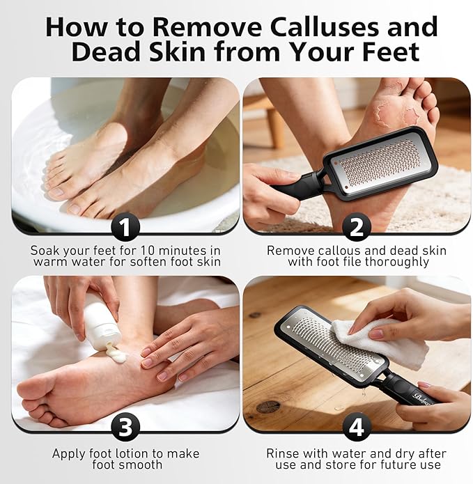 BALUCA Professional Foot File & Callus Remover - Image 8