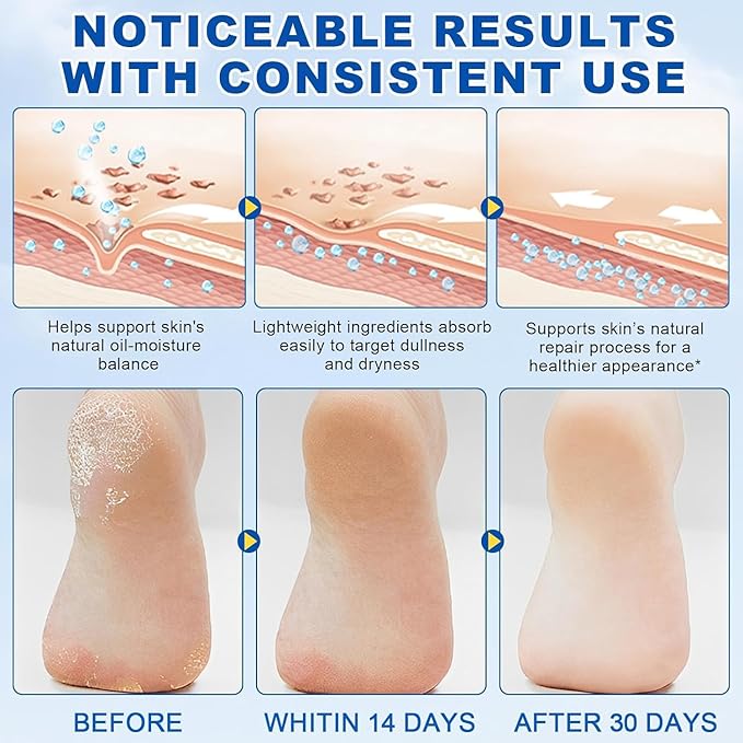 60% Urea Foot Cream Stick Plus 2% Salicylic Acid - Image 6