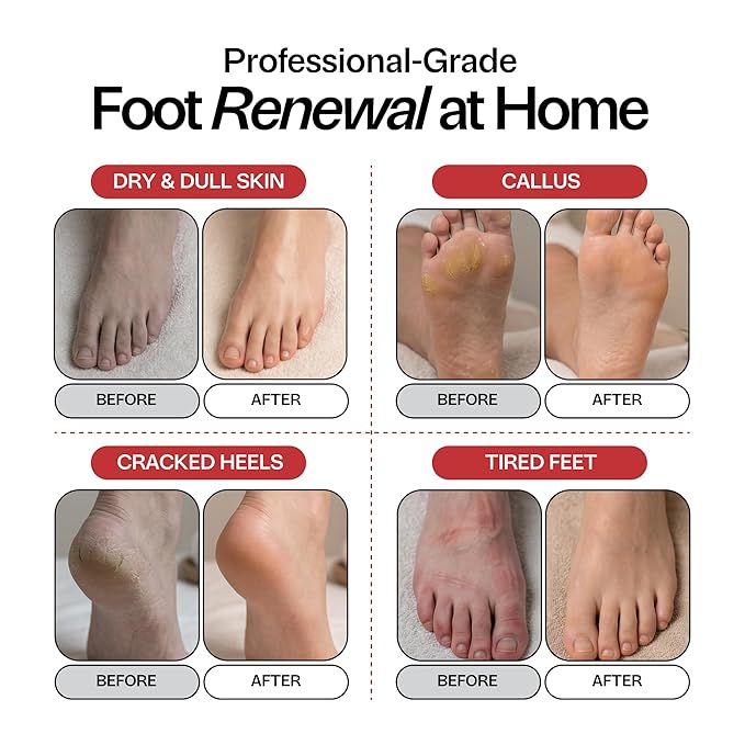 Muscle Soothing Foot Soak with Epsom Salt & Arnica - Image 3
