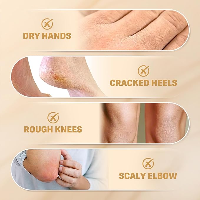 2Pack 60% Urea Cream with 2% Salicylic Acid, Urea Cream 60 Percent - Image 6