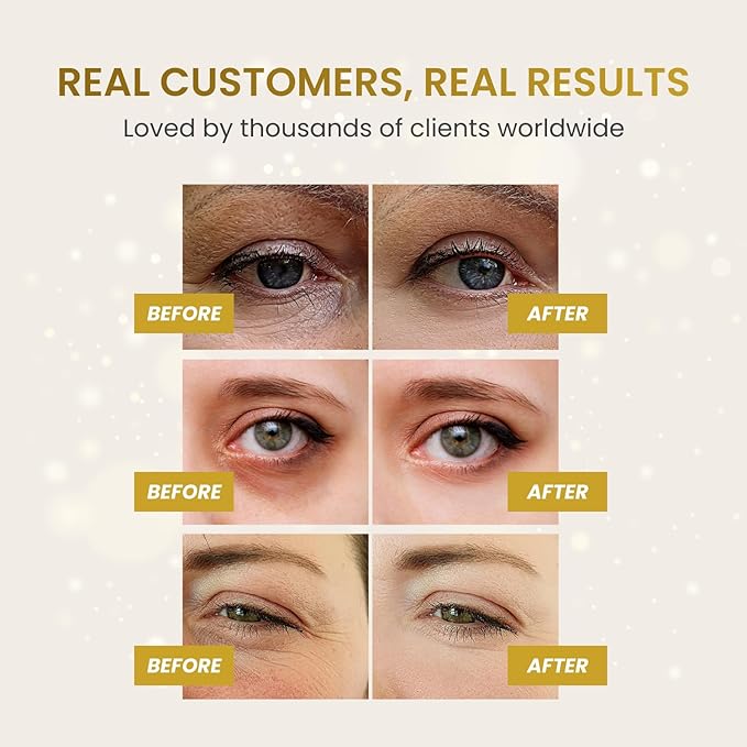PLANTIFIQUE 24K Gold Under Eye Patches 20 Pairs - Image 4