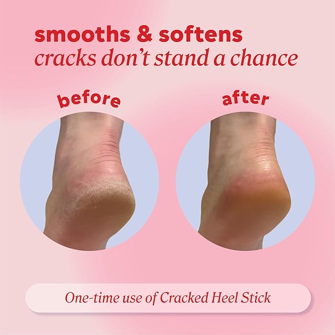 Onyx Professional Cracked Heel Repair Balm Stick - Image 5