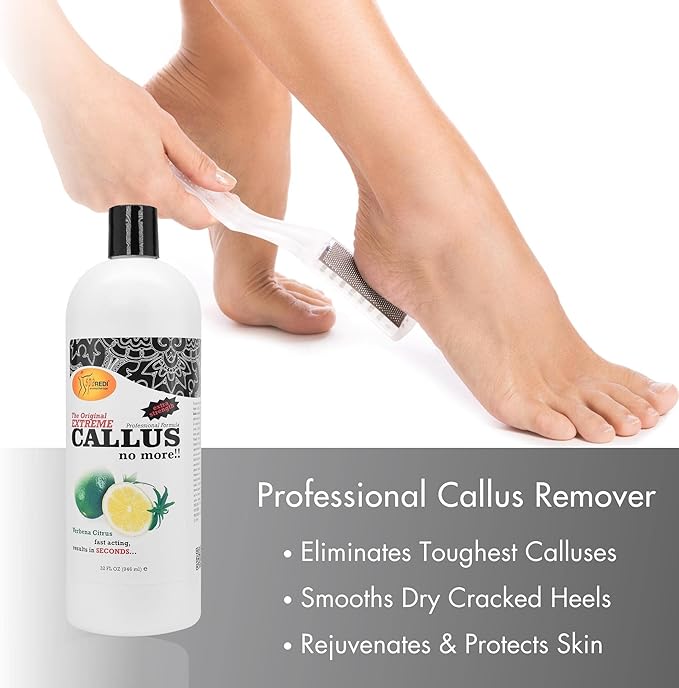 SPA REDI - Callus Remover for Feet Gel - Professional Pedicure Foot Care - - Image 6