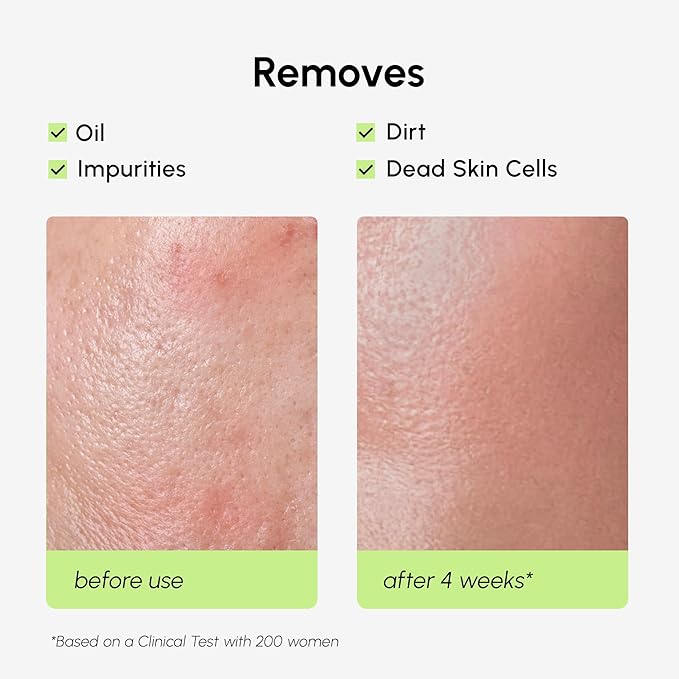 MAREE Exfoliating Toner with Salicylic Acid – AHA BHA Face Exfoliant & Pore - Image 5
