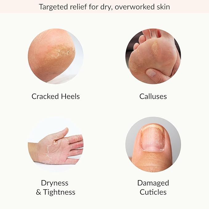 Epielle Hydrating Hand & Foot Masks, Relieve and Soften Dry, Overworked Skin - Image 4