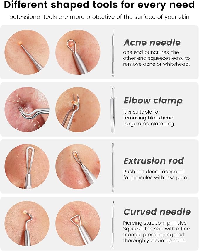 Pimple Popper Tool Kit - Image 4