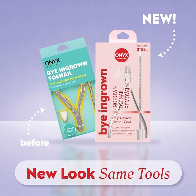 Onyx Professional Ingrown Toenail Kit - Image 2