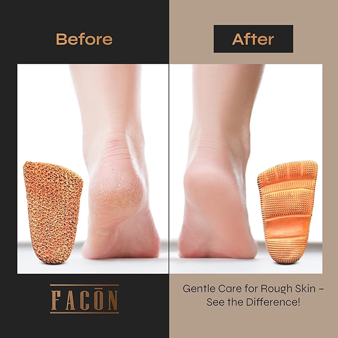Facón Pumice Stone for Feet Callus Remover - Image 6