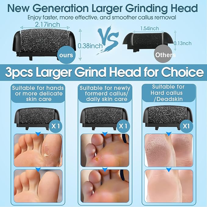 Callus Remover for Feet - Image 3