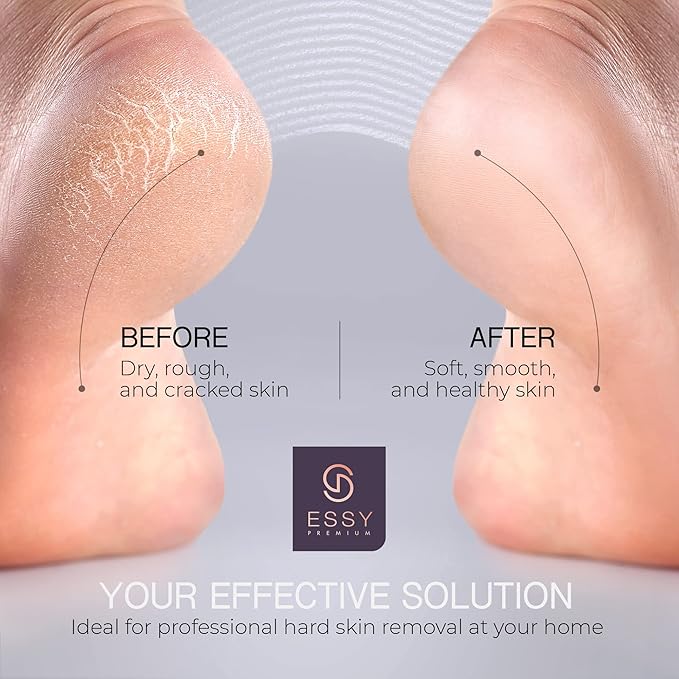Essy Electric Foot File Hard Skin Remover - Image 5