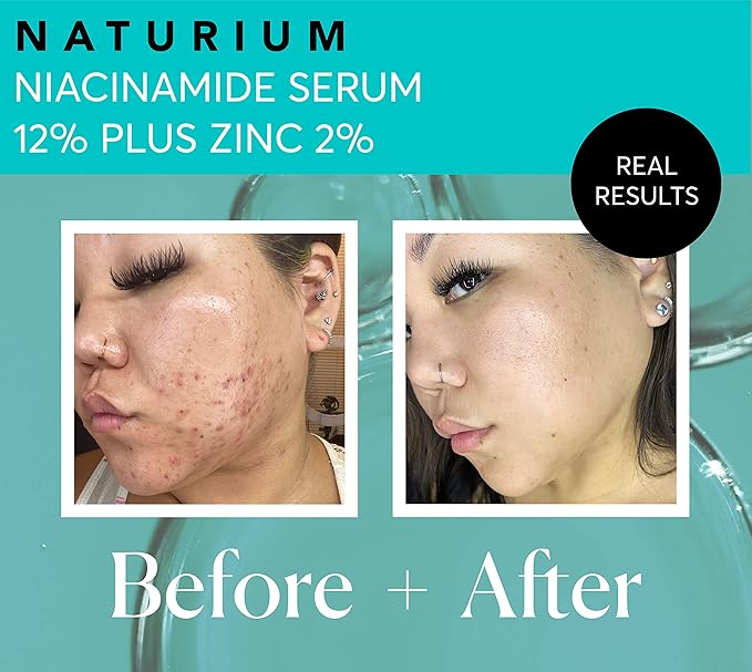 Naturium Niacinamide Face Serum 12% Plus Zinc 2%, Anti-Aging, Pore Minimizer & - Image 5