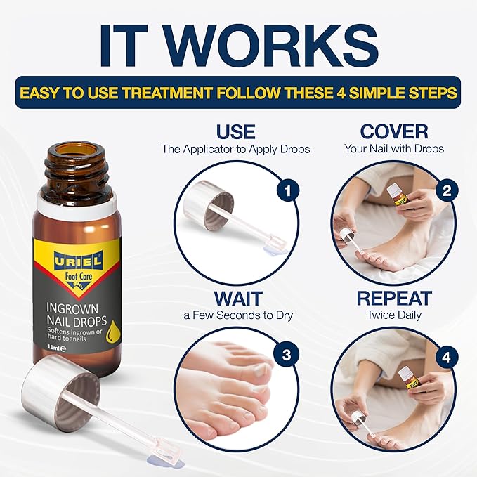 URIEL UPGRADED Ingrown Toenail Treatment, Ingrown Toenail Removal Kit, Ingrown - Image 4