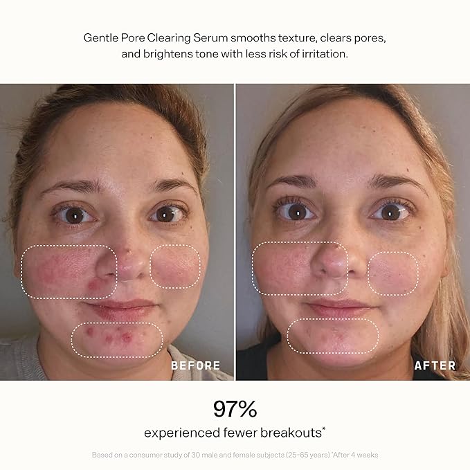 VERSED Skin Refine Gentle Pore Clearing Serum | Exfoliating Facial Serum - Image 8
