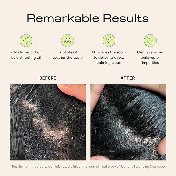 Jupiter Scalp Exfoliator - Image 3