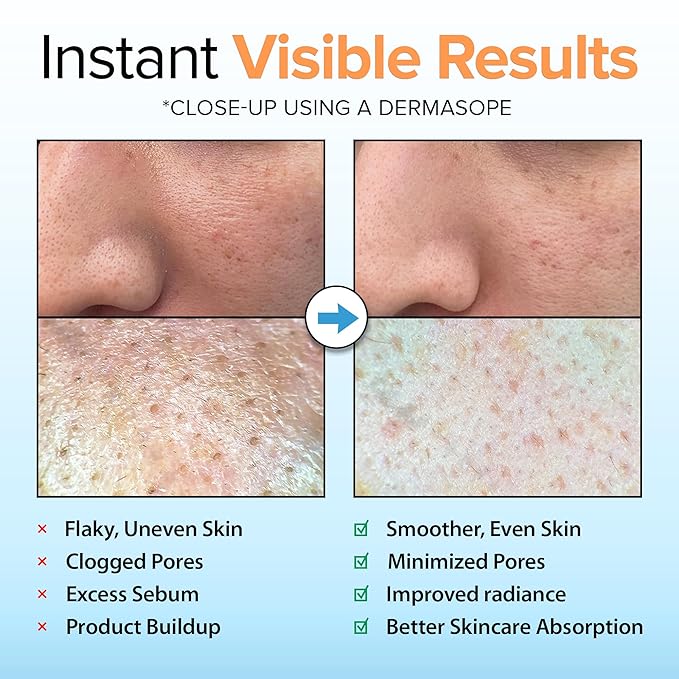 Ebanel Brightening Peeling Gel - Image 3