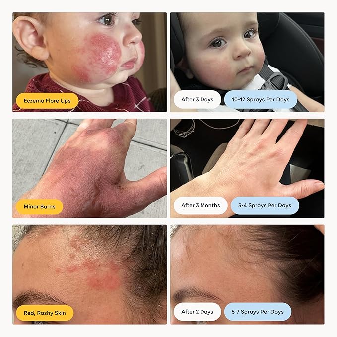 Magic Molecule Skin Cleanser for All Types, Hypochlorous Acid Spray Helps Heal - Image 5