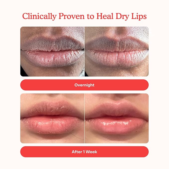 Tower 28 LipSoftie Tinted Lip Balm Treatment - Image 2
