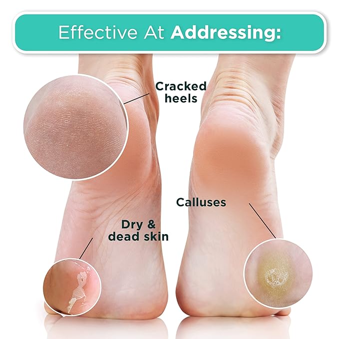 DERMORA Foot Peel Mask | Skin Exfoliating Foot Masks - Image 5