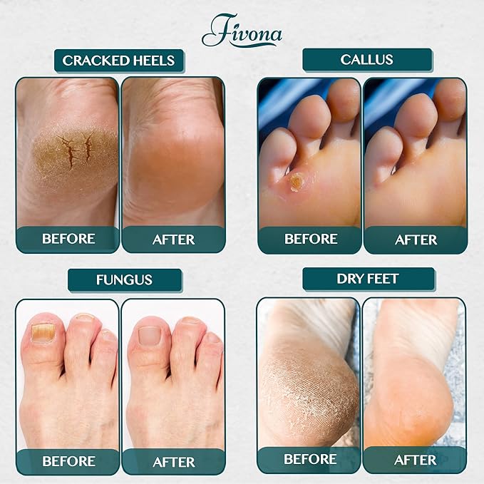 Foot Soak Epsom Salt with Tea Tree Oil 2 LB - Image 8