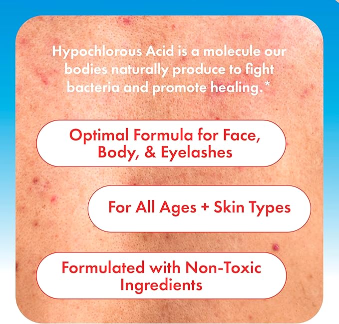Hypochlorous Acid Spray for Face, Skin & Eyelids – pH-Balanced HOCl Facial - Image 4