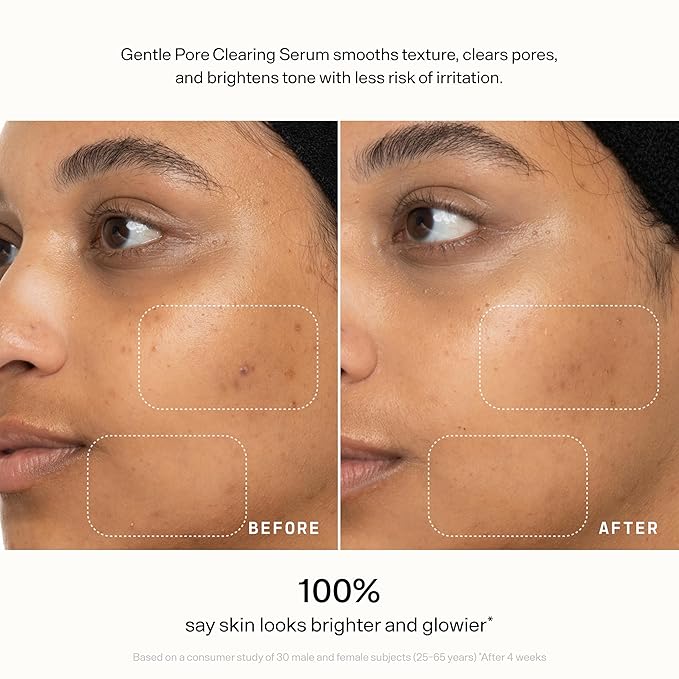 VERSED Skin Refine Gentle Pore Clearing Serum | Exfoliating Facial Serum - Image 11