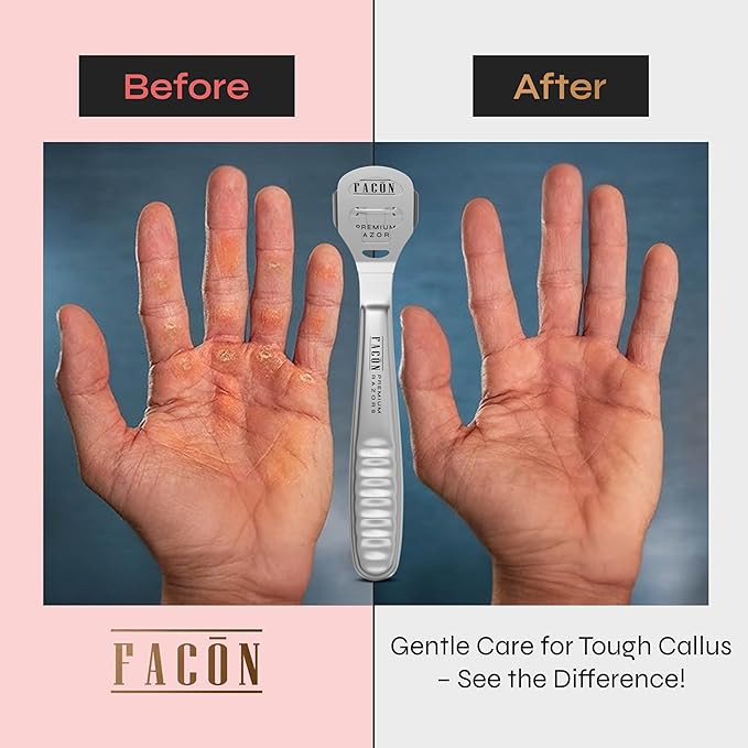 Facón Professional Callus Shaver Remover - Image 4