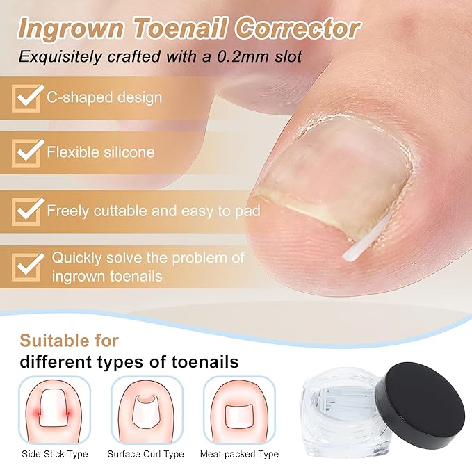 VOCOSTE Ingrown Toenail Correction Kit, Toe Nail Corrector Tools - Image 2