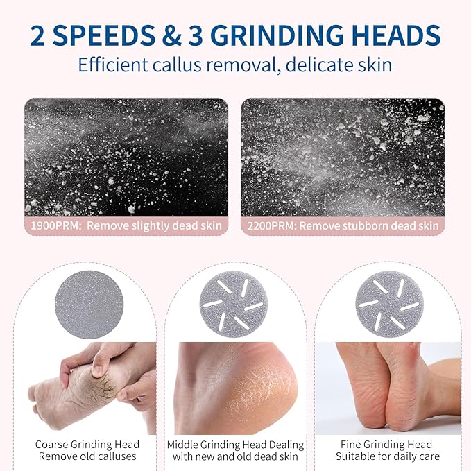 Electric Foot Callus Remover - Image 2