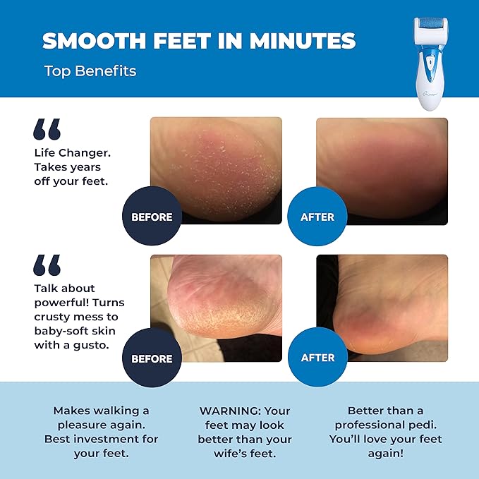 Electric Callus Remover: Own Harmony Professional Pedicure Tools Foot Care - Image 2