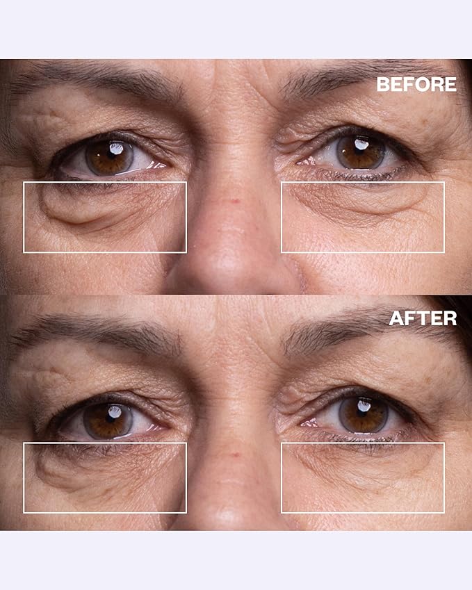 Wrinkles Schminkles Under Eye Patches - Image 3