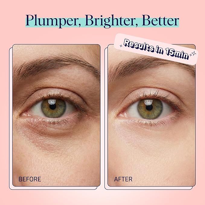 SpaLife Watermelon Cooling Eye Pads, Mothers Day Gifts, 48 Hydrating Under Eye - Image 4