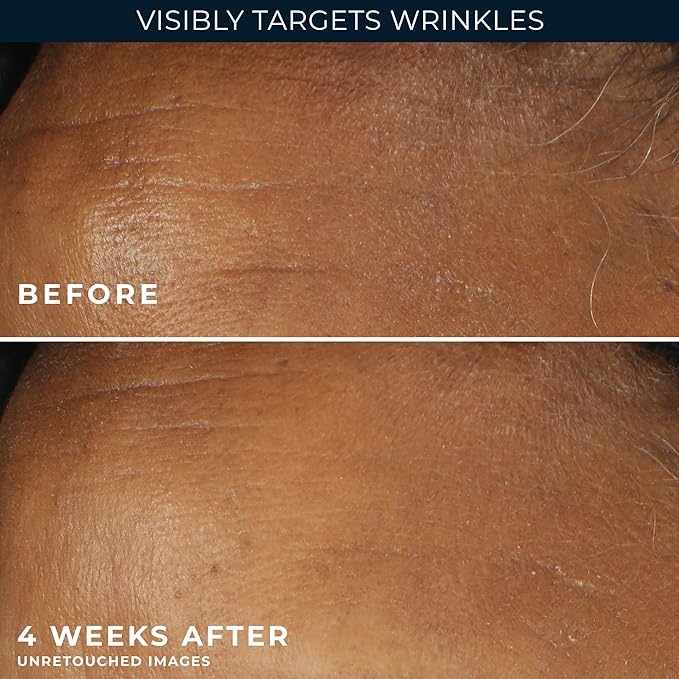 RoC Retinol Correxion Deep Wrinkle Daily Face Moisturizer - Image 6