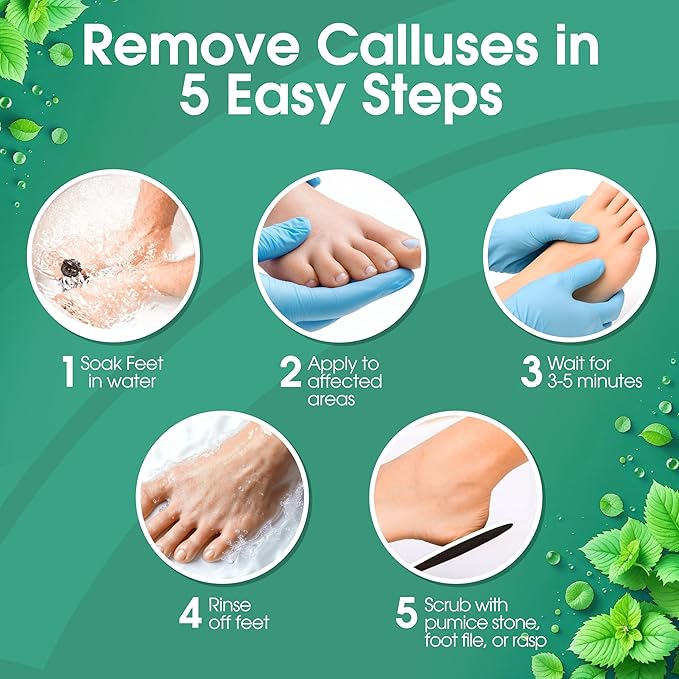DeEnti Callus Maintenance Pack, Bundle Includes Mint Scented Callus Remover - Image 4