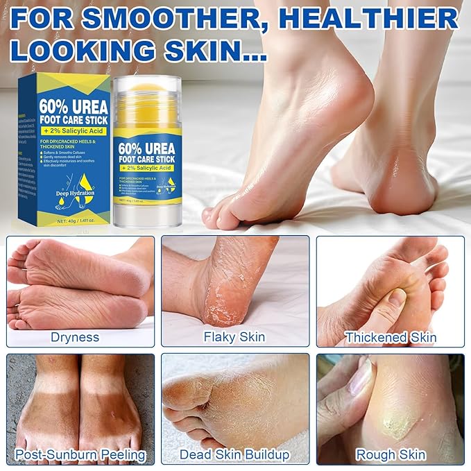 60% Urea Stick with 2% Salicylic Acid, Maximum Strength Callus Remover & - Image 6