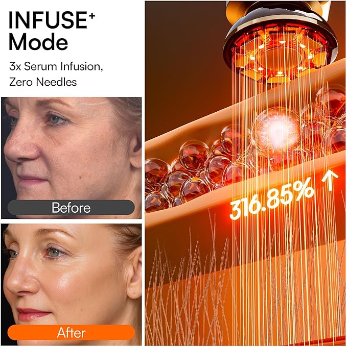 INIA Flare 3-in-1 Microcurrent Facial Device Red Light Therapy - Image 6