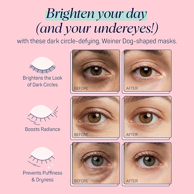 SpaLife So Fetch Hydrogel Under Eye Patches - Image 5