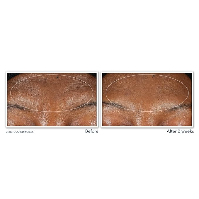 RoC Retinol Correxion Deep Wrinkle Serum Facial Cleanser - Image 4