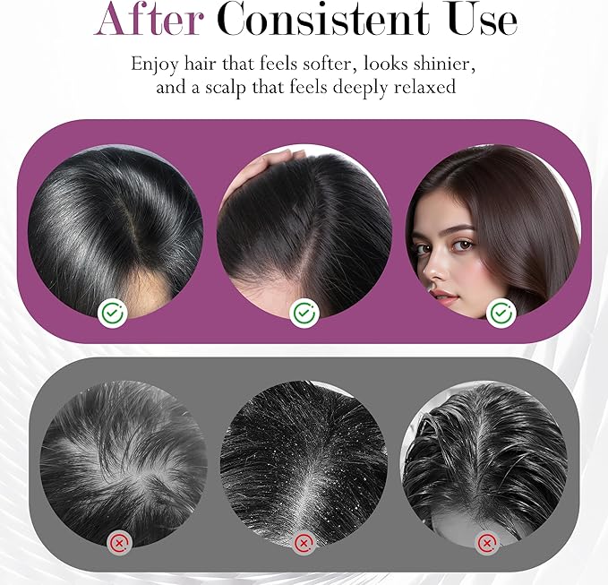 3-in-1 Rechargeable Scalp Massager Hair Growth Oil Applicator, Gentle - Image 3