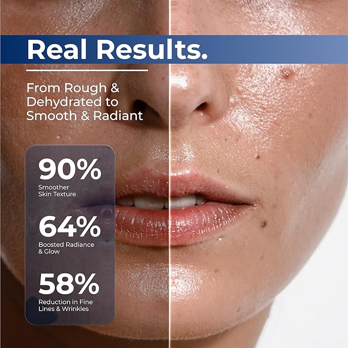 TURMSKIN® Hyaluronic Acid Serum Ampoules - Image 6