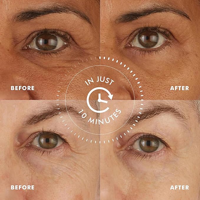 skyn ICELAND Hydro Cool Firming Under Eye Patches. Eye Gel Mask to Firm And - Image 3