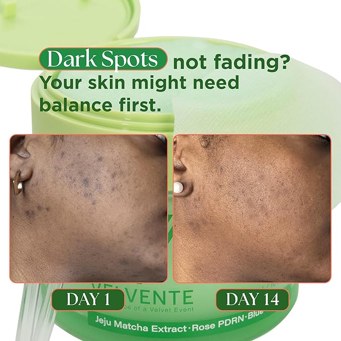 Matcha Toner Pads with Rose PDRN, Peptides & Hyaluronic Acid | Korean Facial - Image 2